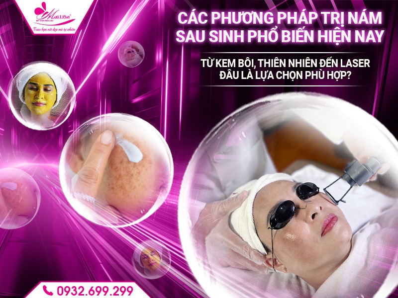 cong-nghe-tri-nam-cho-phu-nu-sau-sinh