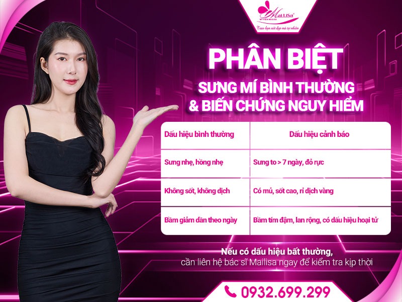 cach-giam-sung-nhanh-sau-cat-mi