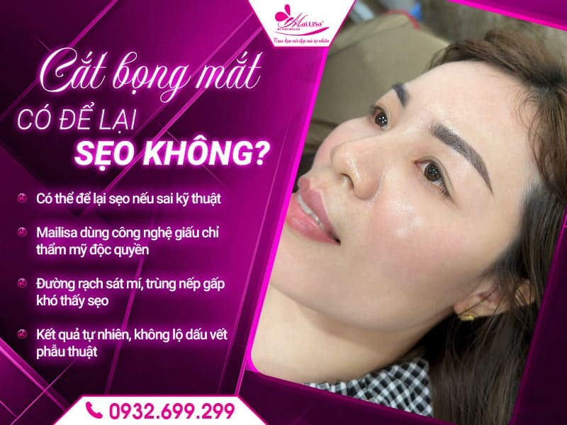 cat-bong-mat-co-de-lai-seo-khong