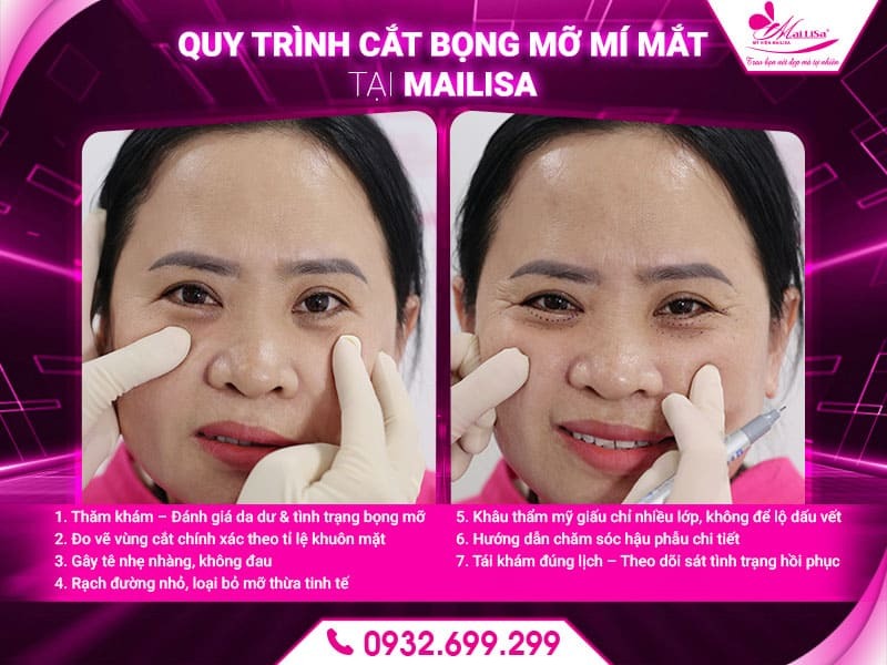 cat-bong-mat-co-de-lai-seo-khong