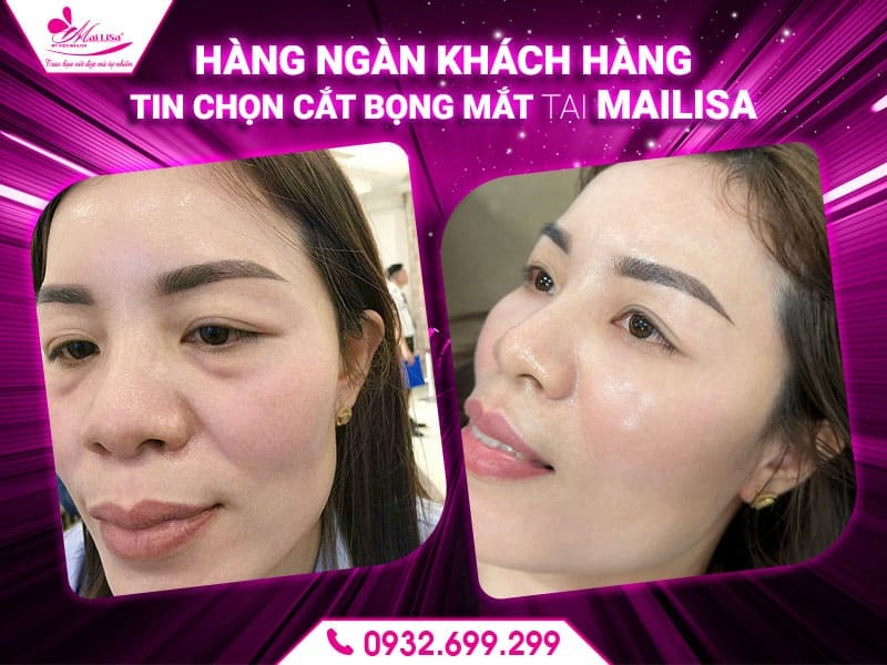 cat-bong-mat-co-de-lai-seo-khong