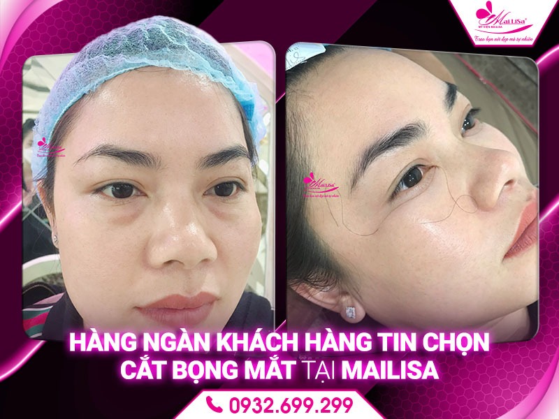 cat-bong-mat-o-dau-an-toan