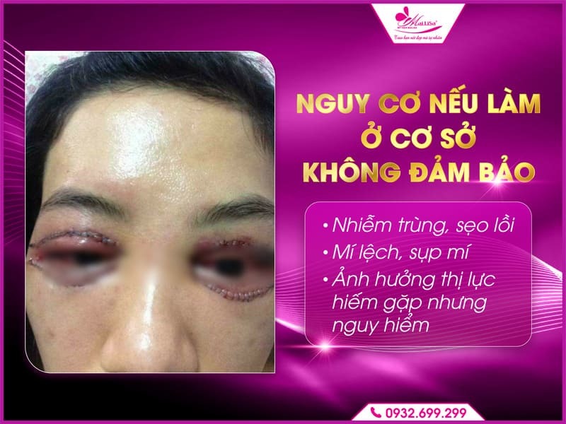 cat-mi-duoi-co-anh-huong-gi-khong
