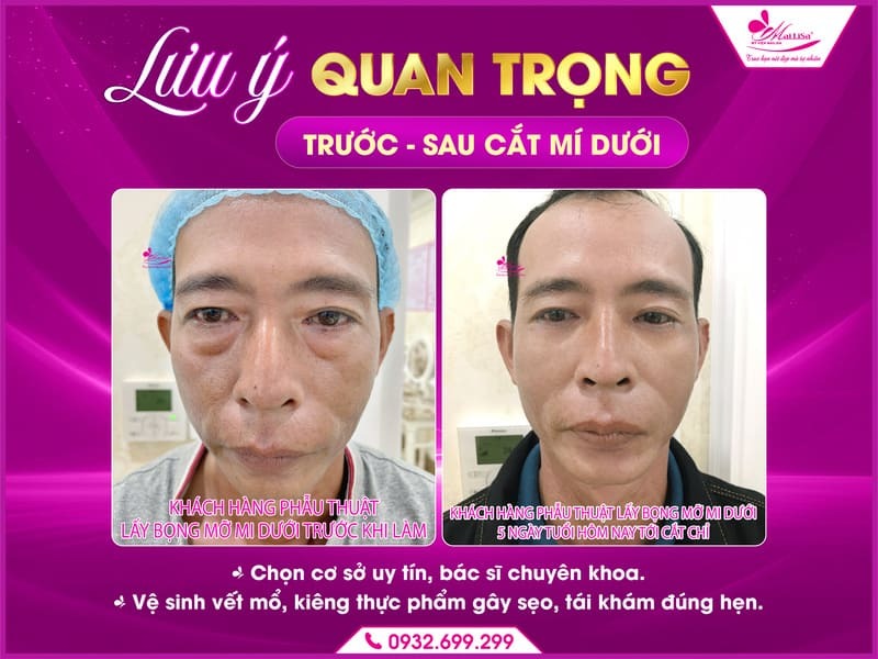 cat-mi-duoi-co-anh-huong-gi-khong