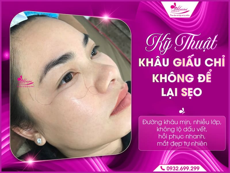 cat-mi-duoi-co-anh-huong-gi-khong