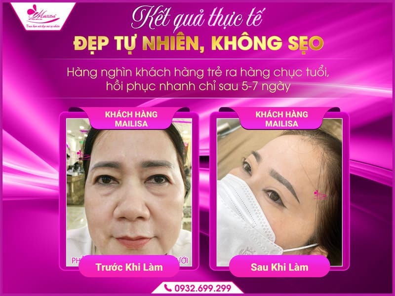 cat-mi-duoi-co-anh-huong-gi-khong