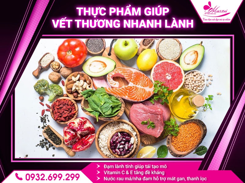 cat-mi-kieng-an-gi-de-tranh-bien-chung
