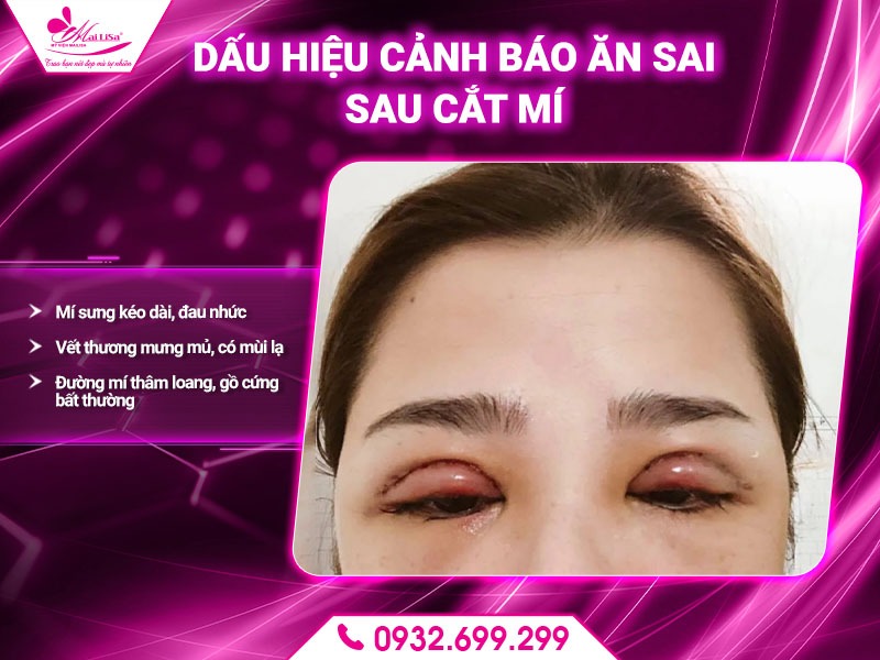 cat-mi-kieng-an-gi-de-tranh-bien-chung