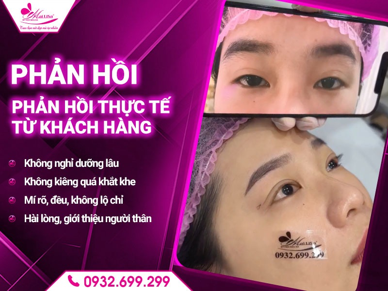 cat-mi-kieng-an-gi-de-tranh-bien-chung