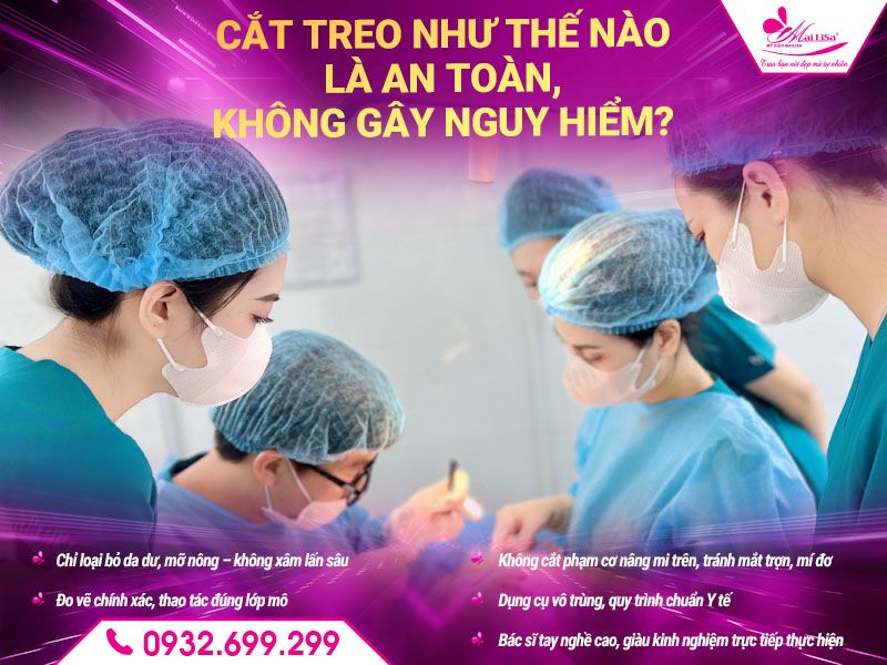 cat-treo-nhu-the-nao-la-an-toan