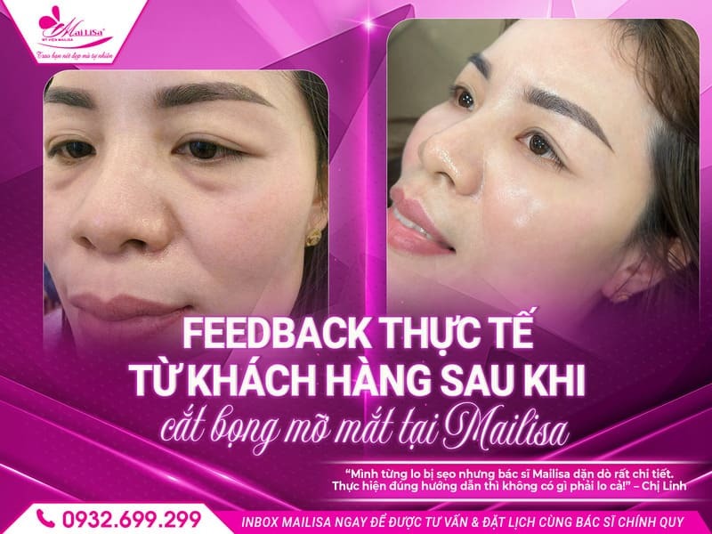 cham-soc-sau-khi-cat-bong-mat-nhu-the-nao