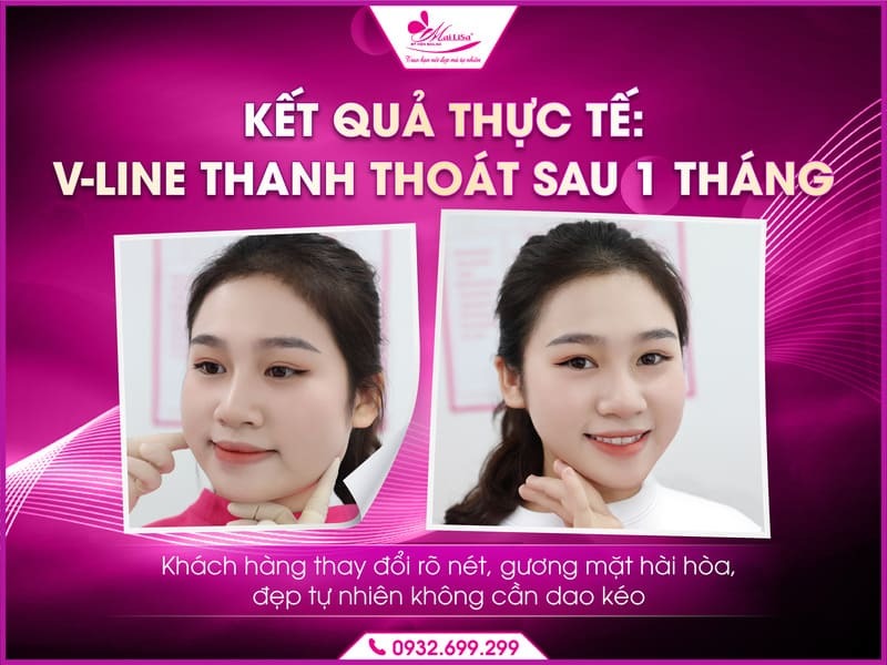 cong-dung-botox-gon-ham