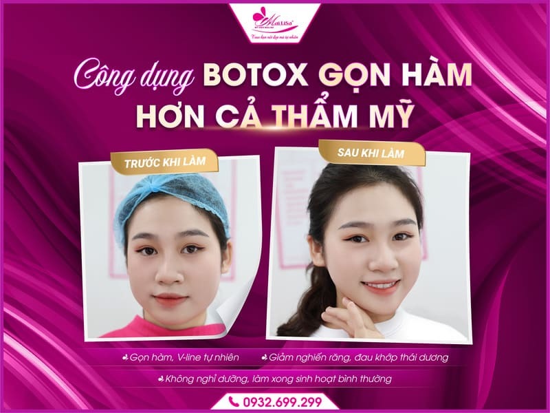 cong-dung-botox-gon-ham