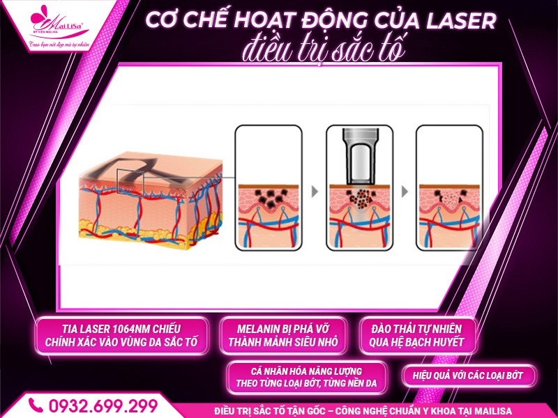 cong-nghe-dieu-tri-bot-sac-to
