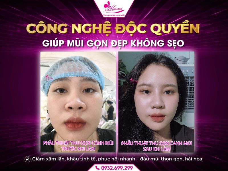cong-nghe-doc-quyen-giup-mui-gon-dep-khong-seo