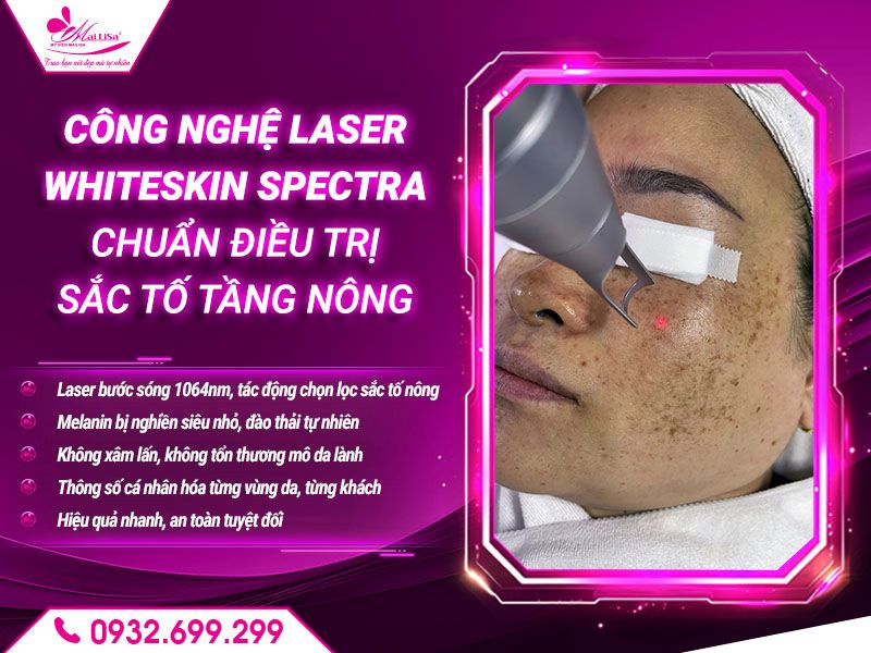 cong-nghe-laser-whiteskin-spectra