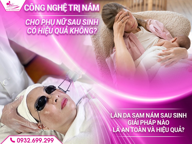 cong-nghe-tri-nam-cho-phu-nu-sau-sinh