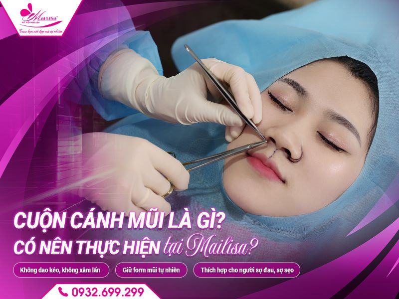 cuon-canh-mui-la-gi-co-nen-thuc-hien-tai-mailisa-