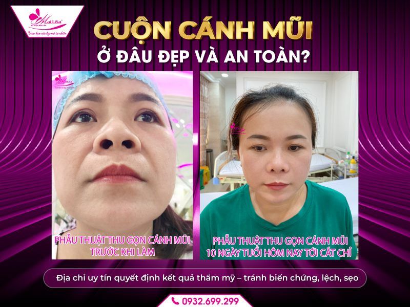 cuon-canh-mui-o-dau-dep-va-an-toan