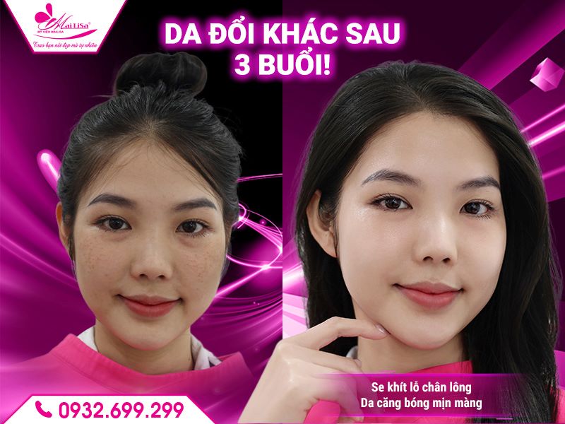 da-doi-khac-sau-3-buoi