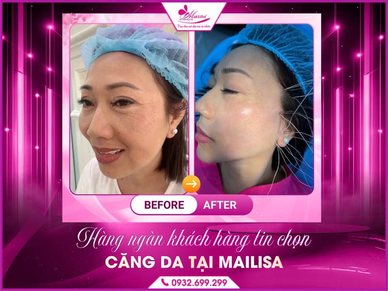 dat-lich-bac-si-cang-da-mailisa
