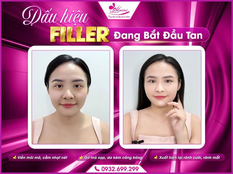 filler-tan-sau-bao-lau