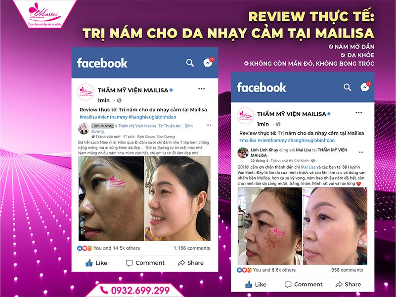 dieu-tri-nam-cho-da-nhay-cam