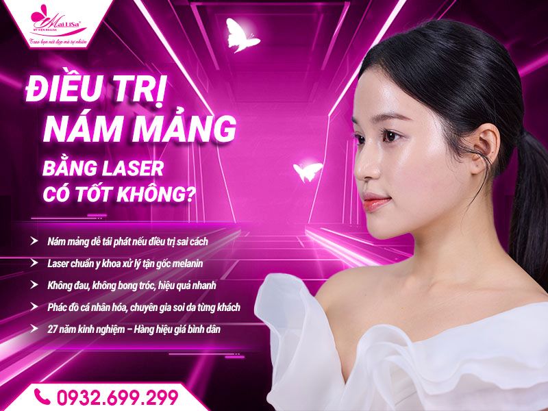 dieu-tri-nam-mang-bang-laser-co-tot-khong