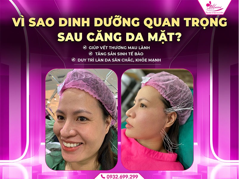 https://mailisa.com/wp-content/uploads/2025/08/thuc-pham-nen-an-sau-khi-cang-da-mat.jpg