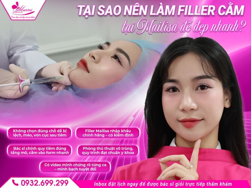 filler-cam-bao-lau-thi-dep