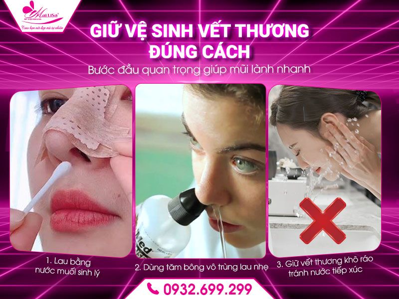giu-ve-sinh-vet-thuong-dung-cach