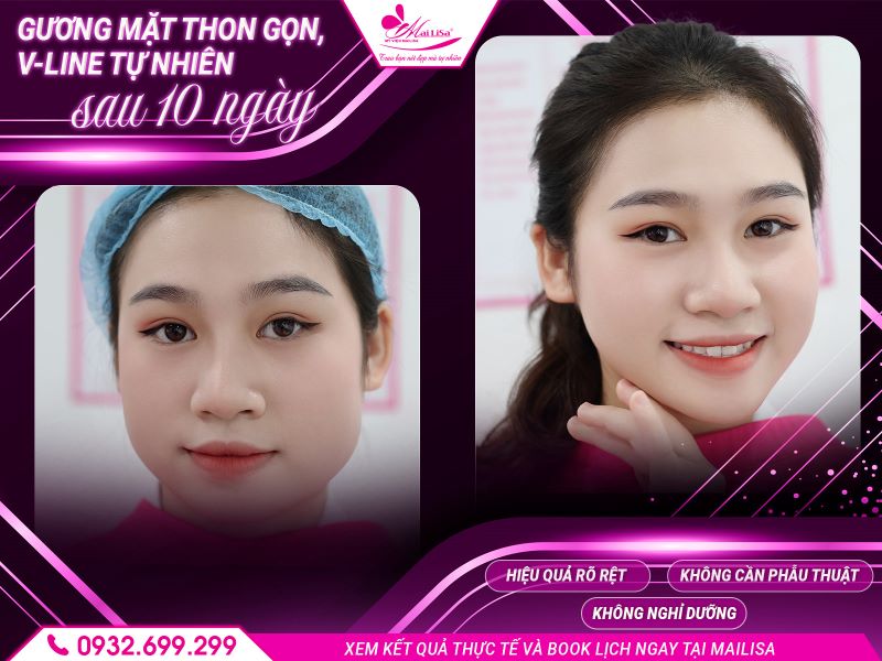 guong-mat-thon-gon