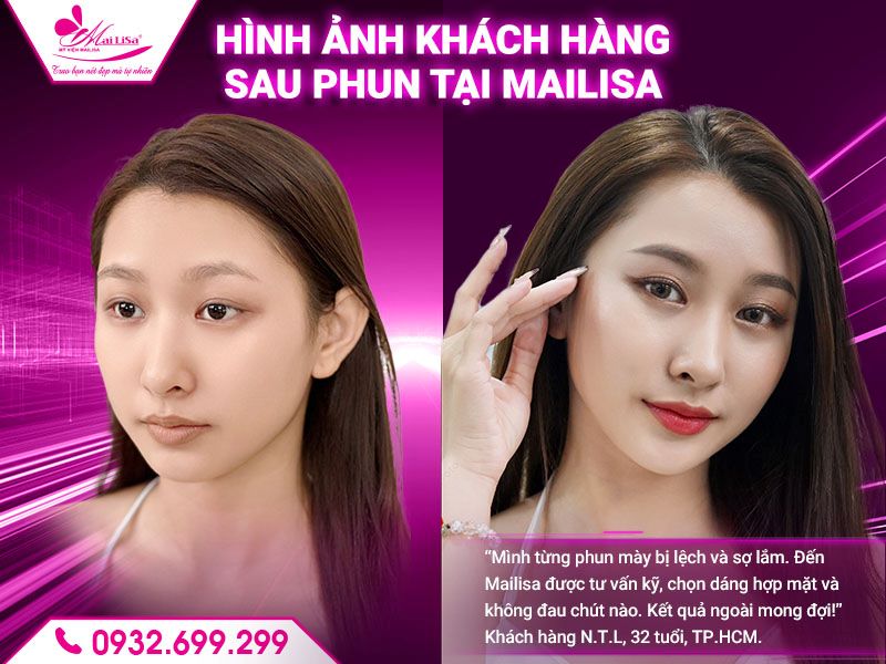 hinh-anh-khach-hang-sau-phun-tai-mailisa