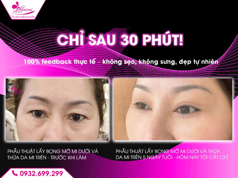 khach-hang