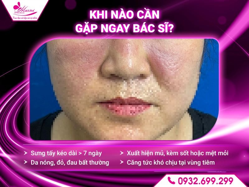 lam-dep-bap-co-bi-sung-khong
