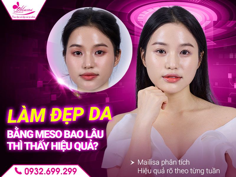 lam-dep-da-bang-meso-bao-lau-thay-hieu-qua