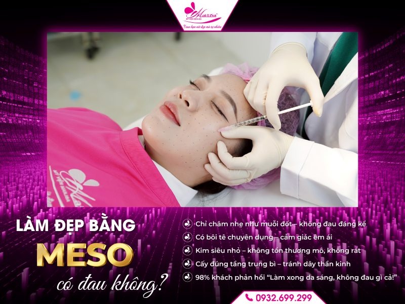 lam-dep-bang-meso-co-dau-khong