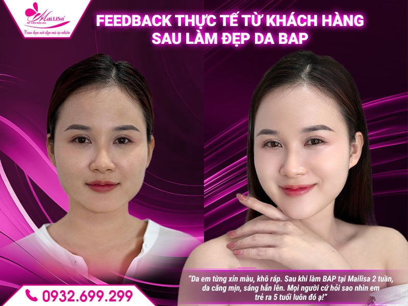 lam-dep-da-bap-co-tot-khong