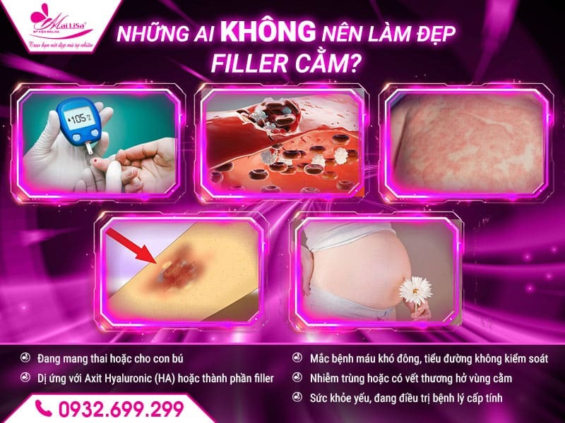 lam-dep-filler-cam-co-an-toan-khong