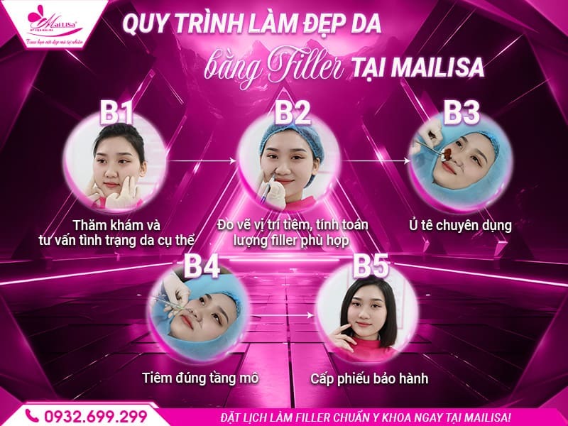lam-dep-filler-co-cang-da-duoc-khong