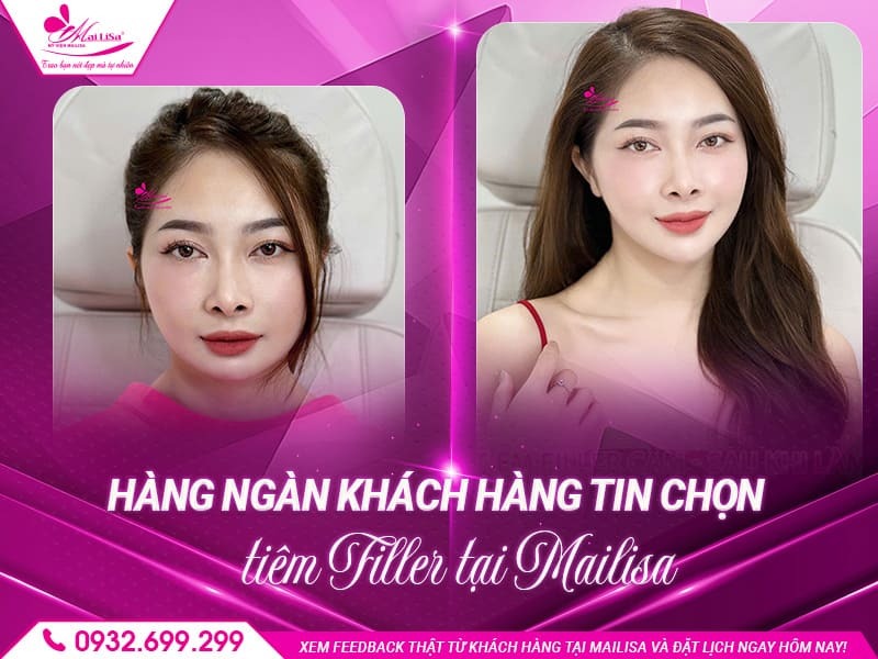 lam-dep-filler-co-cang-da-duoc-khong
