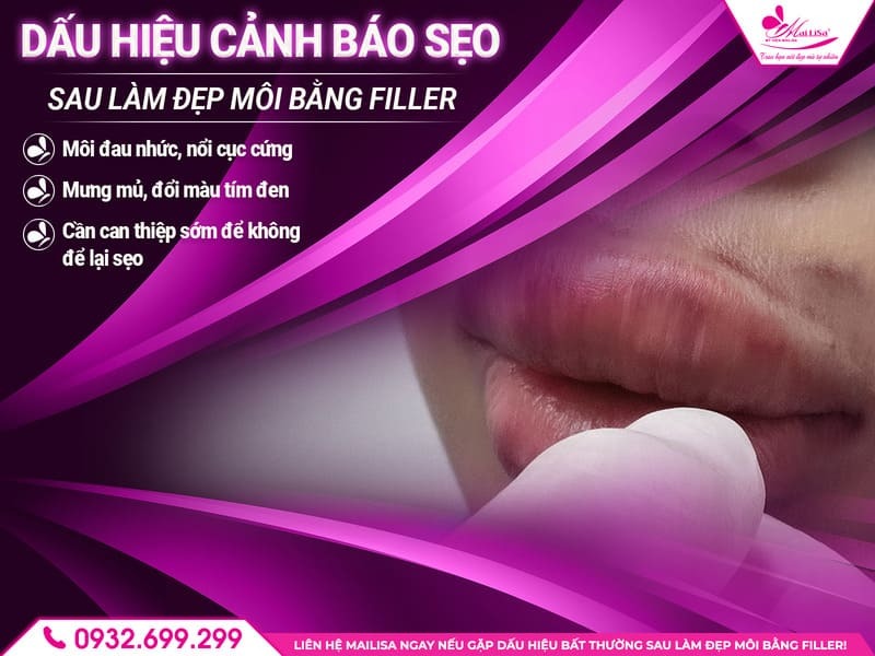 filler-moi-co-de-lai-seo-khong
