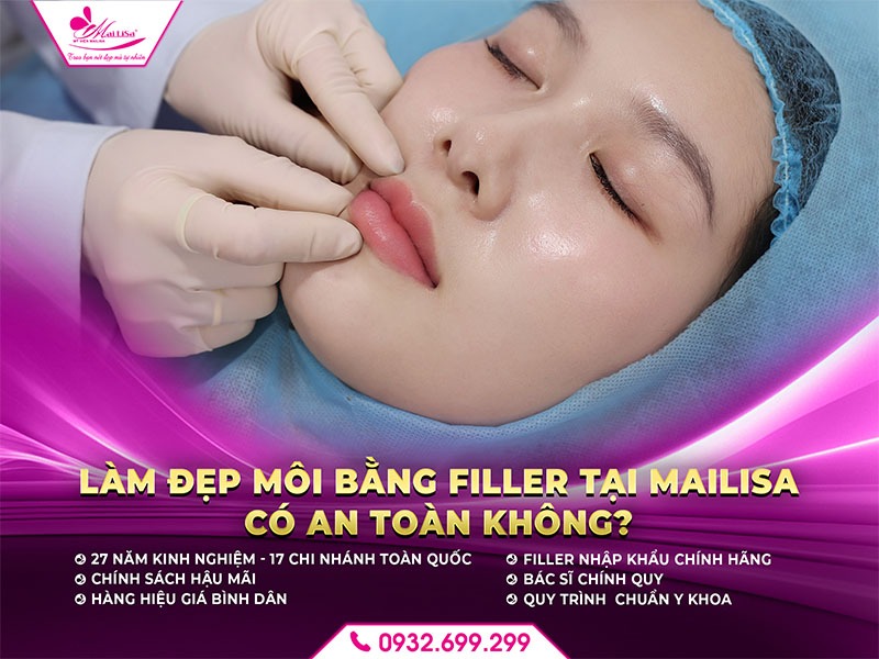 lam-dep-filler-moi-co-an-toan-khong