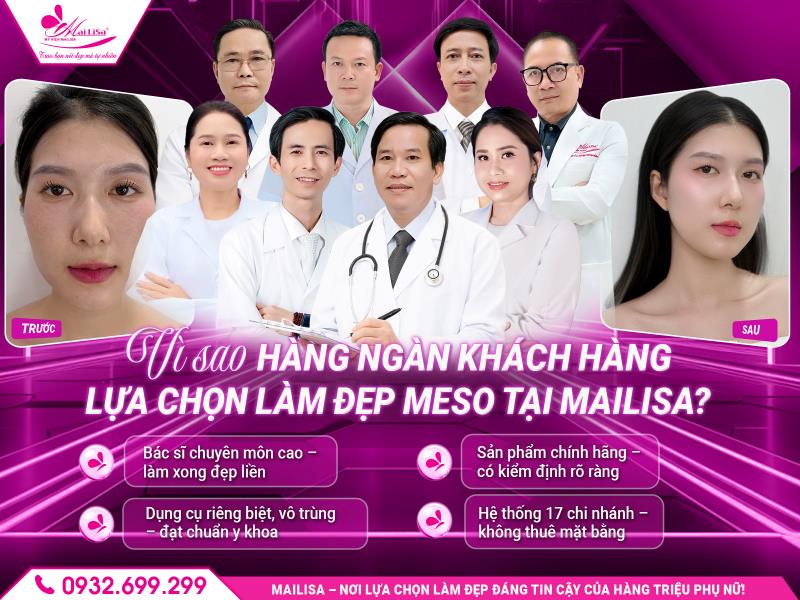 lam-dep-meso-tai-mailisa