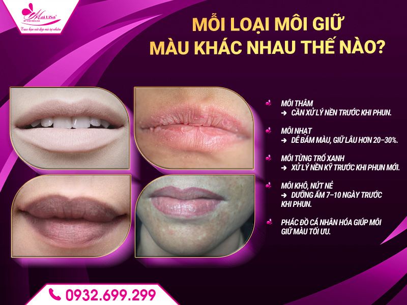 moi-loai-moi-giu-mau-khac-nhau-the-nao