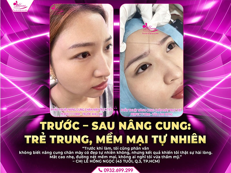 nang-cung-chan-may-co-dep-tu-nhien-khong