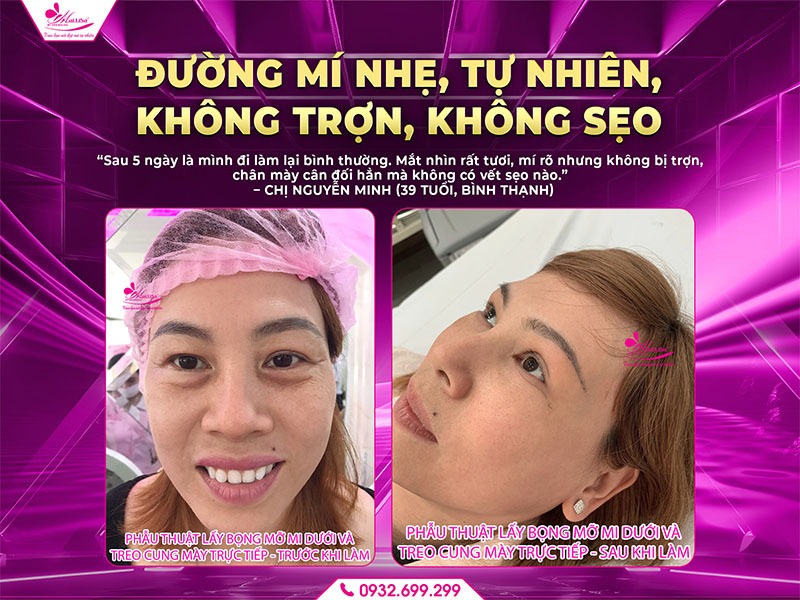 nang-cung-chan-may-co-dep-tu-nhien-khong