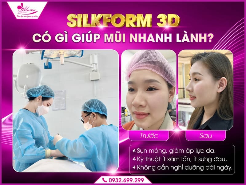 nang-mui-silkform-3d-bao-lau-thi-lanh
