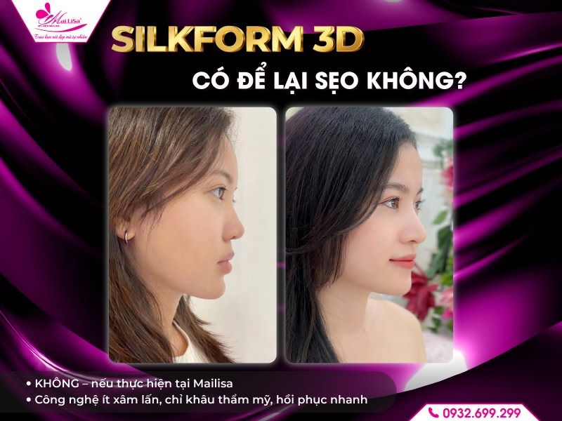 nang-mui-silkform-3d-co-de-lai-seo-khong