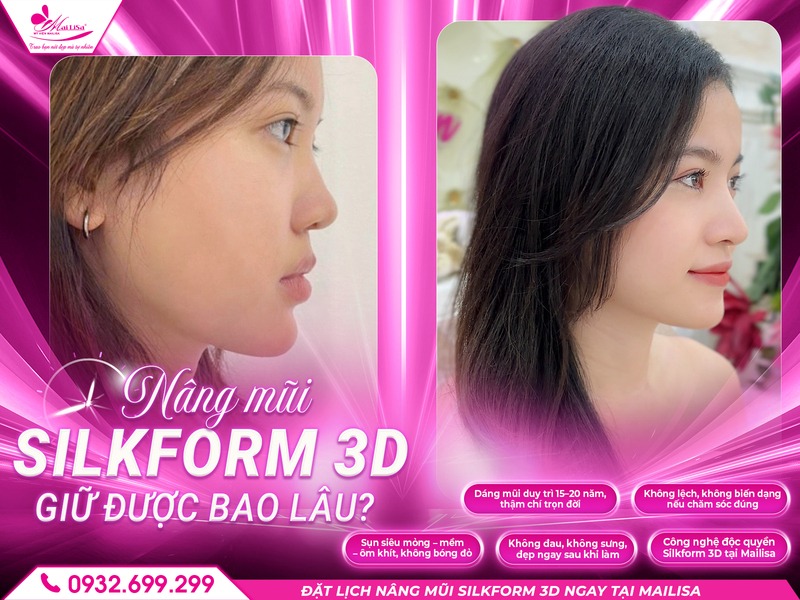 nang-mui-silkform-3d-giu-duoc-bao-lau